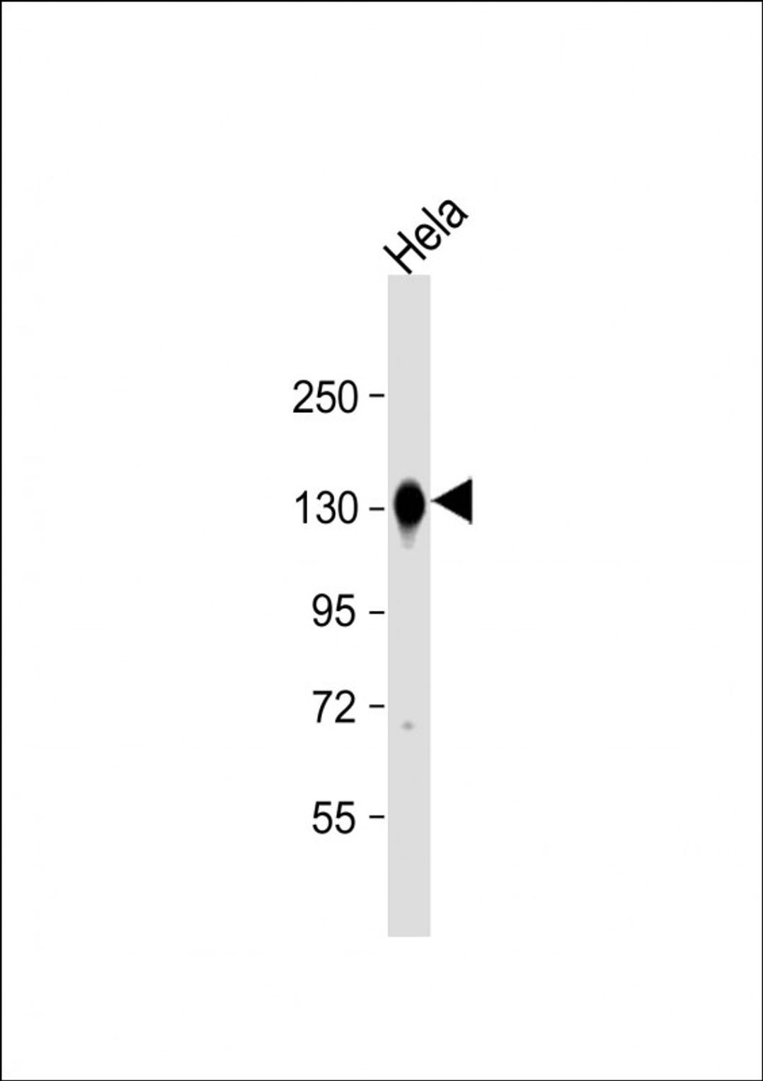 Western Blot at 1:8000 dilution + Hela whole cell lysate Lysates/proteins at 20 ug per lane.