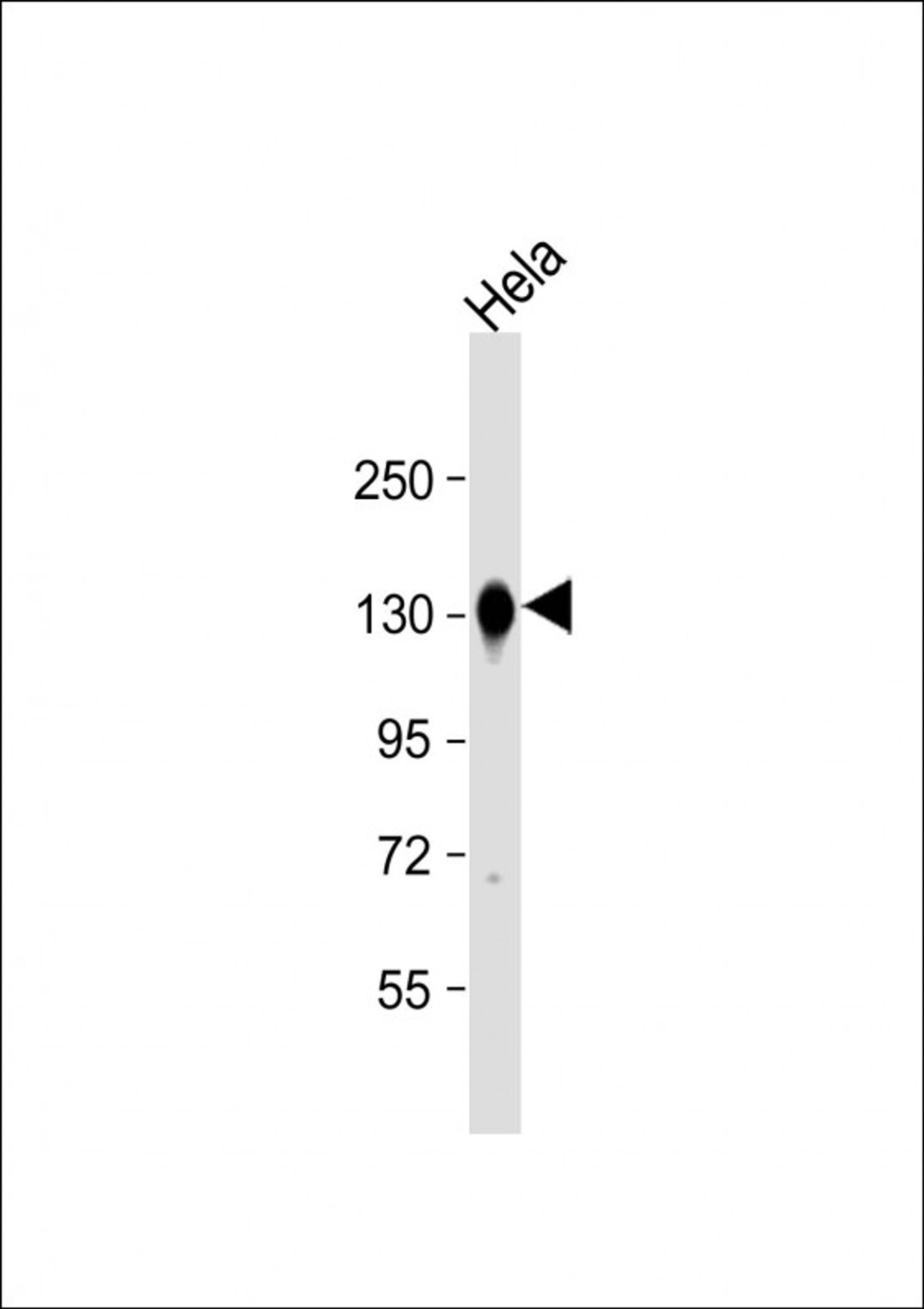 Western Blot at 1:8000 dilution + Hela whole cell lysate Lysates/proteins at 20 ug per lane.