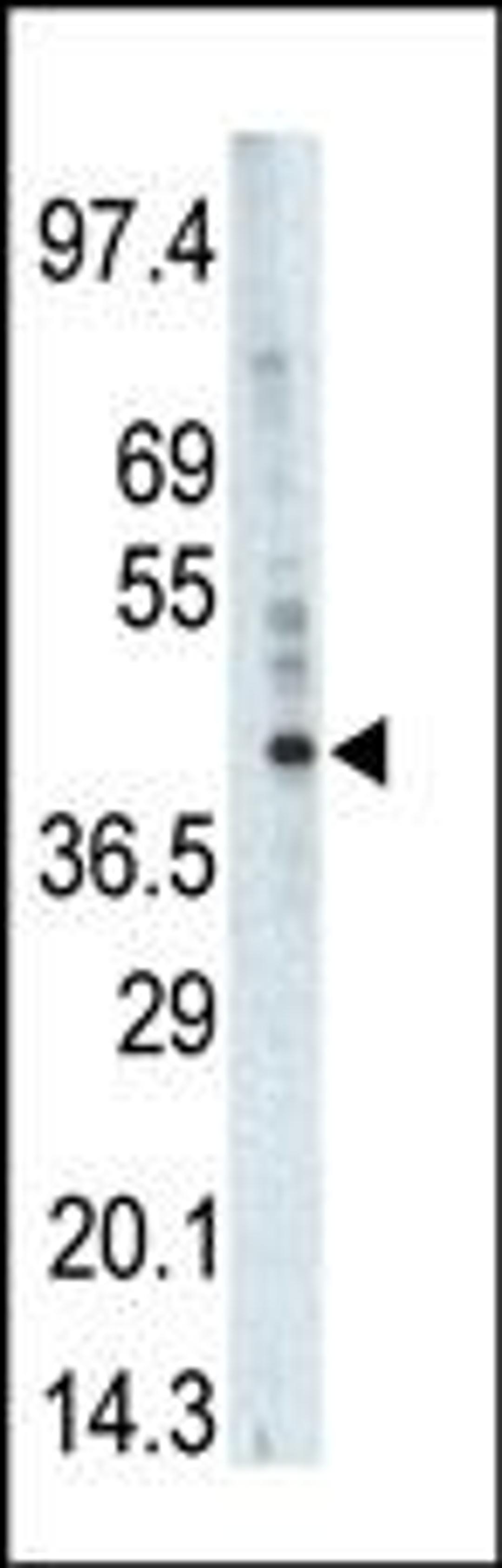 Western blot analysis of anti-PHKG1 Pab in A375 cell lysate