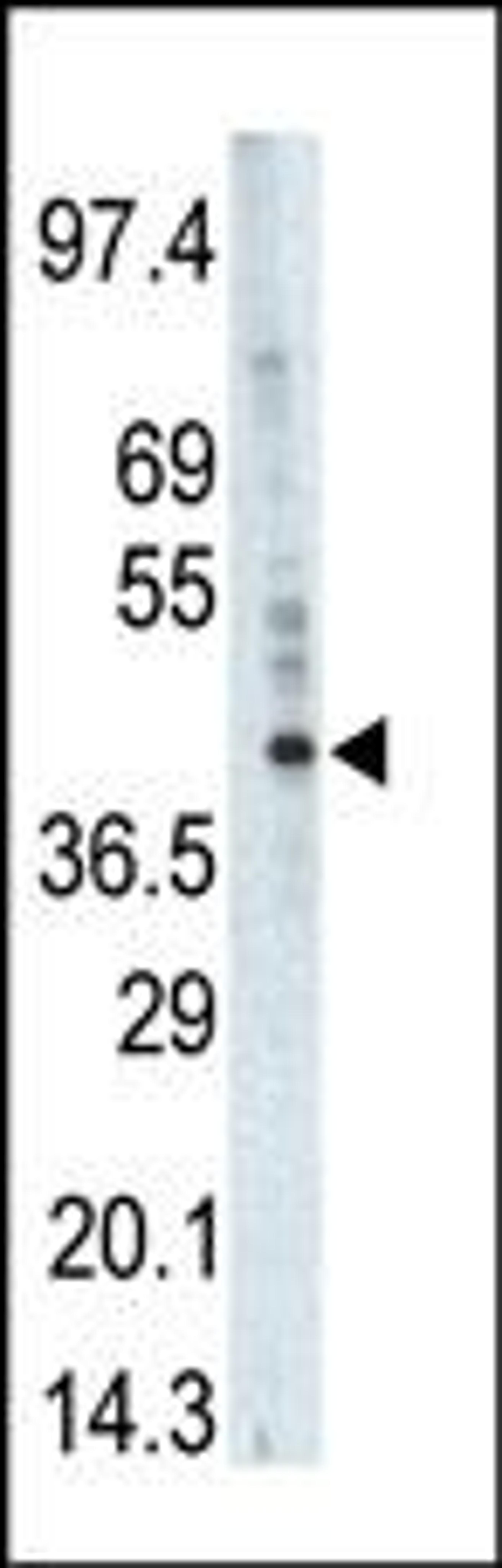 Western blot analysis of anti-PHKG1 Pab in A375 cell lysate