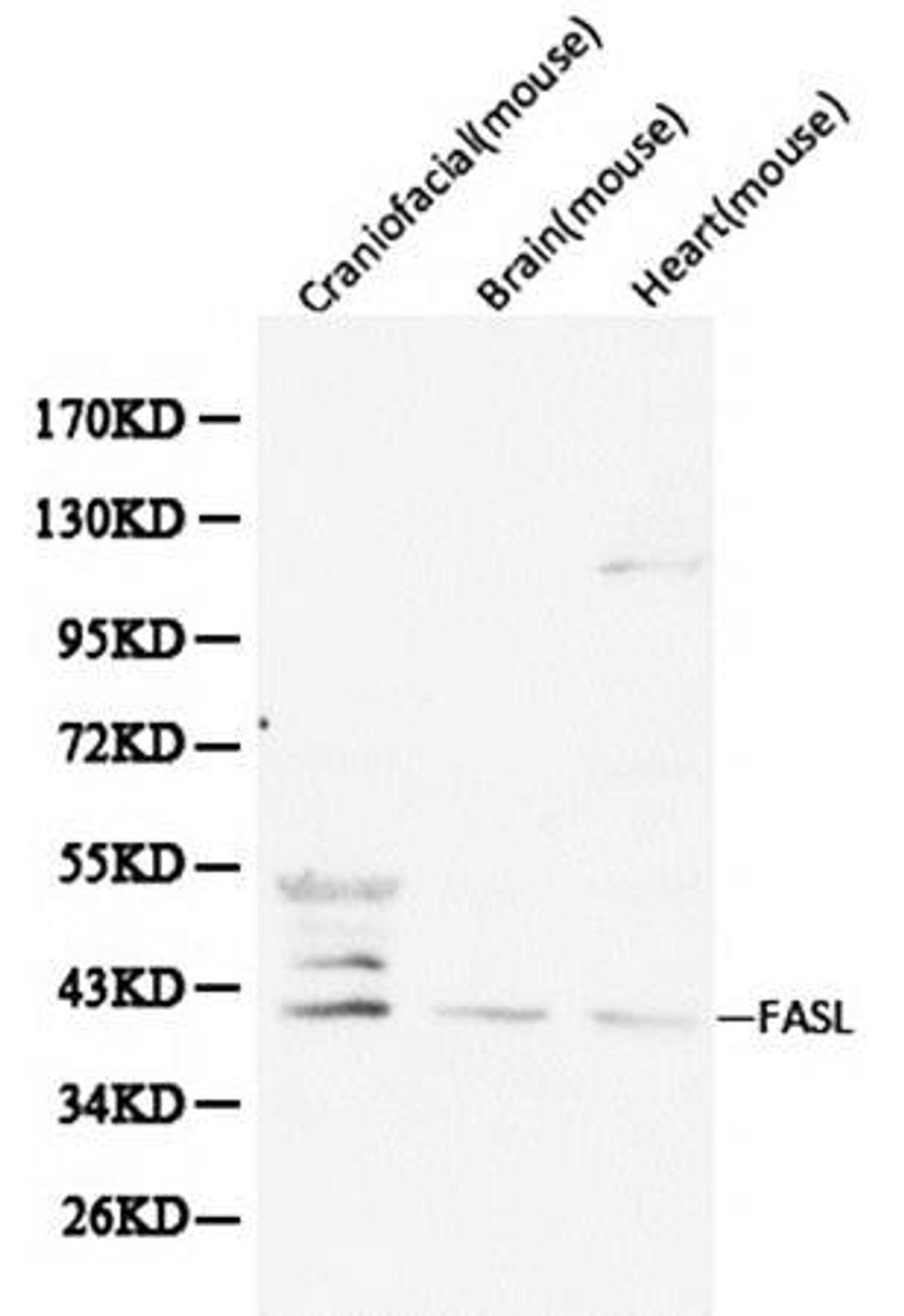 Western blot analysis of extracts from various cell line lysates using FasL antibody