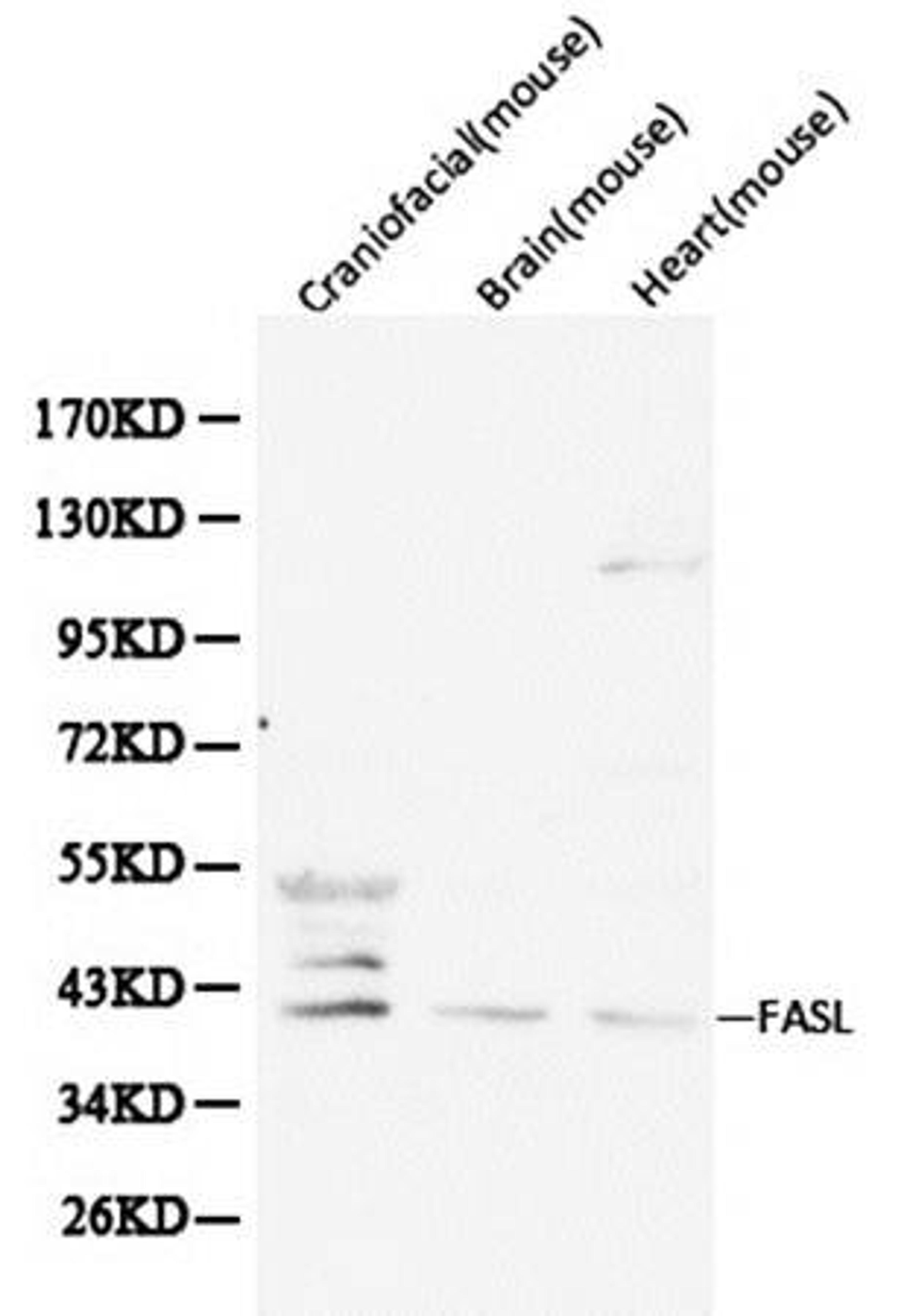 Western blot analysis of extracts from various cell line lysates using FasL antibody