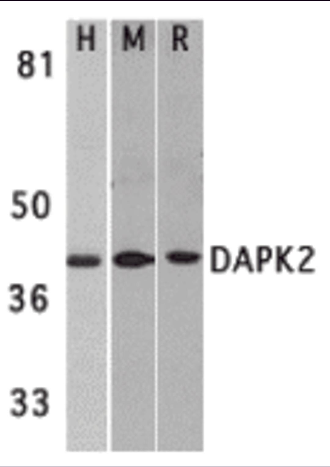 Western blot analysis of DAPK2 in A431 (H), mouse spleen (M), and rat kidney (R) lysates with DAPK2 antibody at 1 &#956;g/mL. 