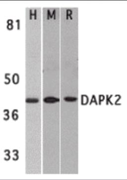 Western blot analysis of DAPK2 in A431 (H), mouse spleen (M), and rat kidney (R) lysates with DAPK2 antibody at 1 &#956;g/mL. 