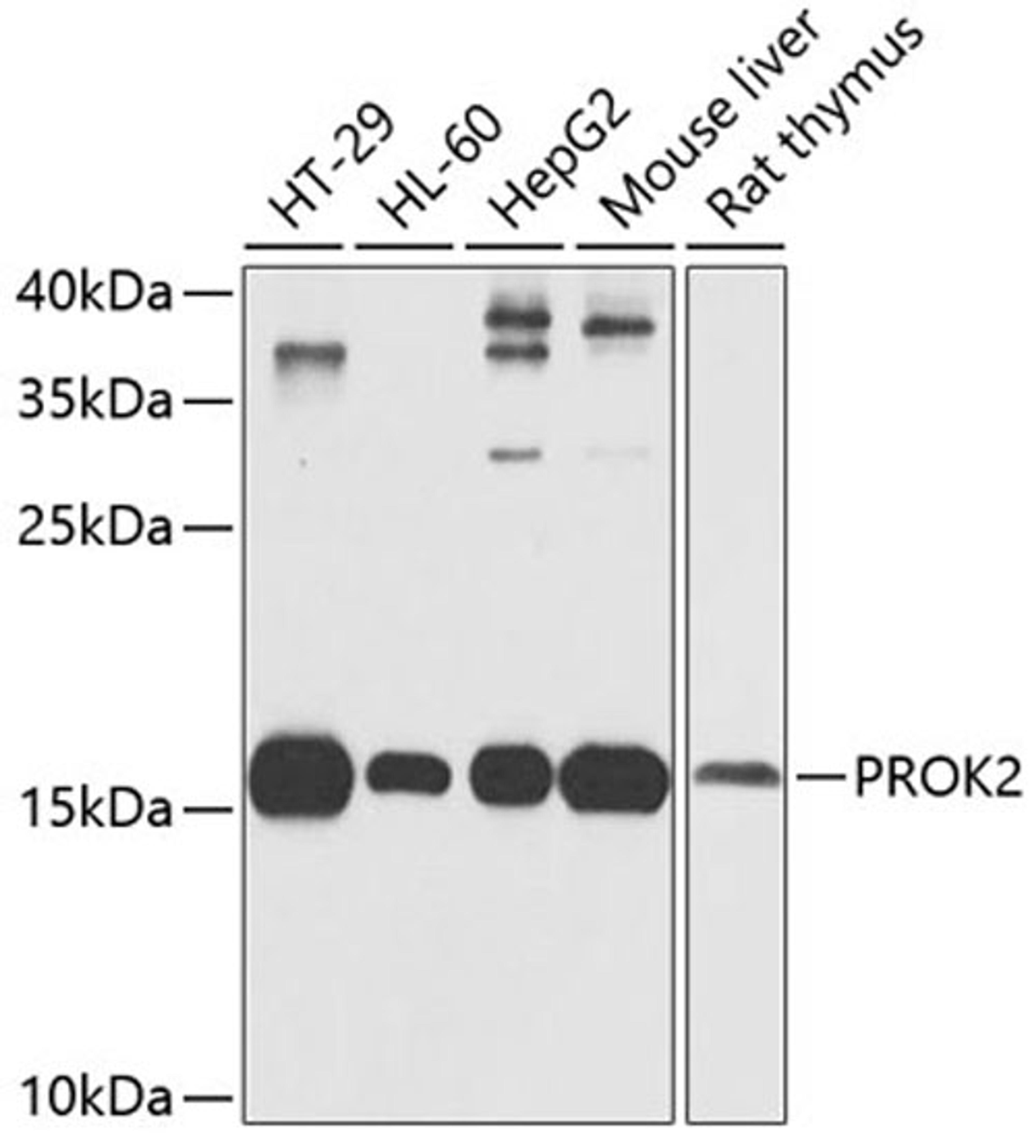 Western blot - PROK2 antibody (A6705)