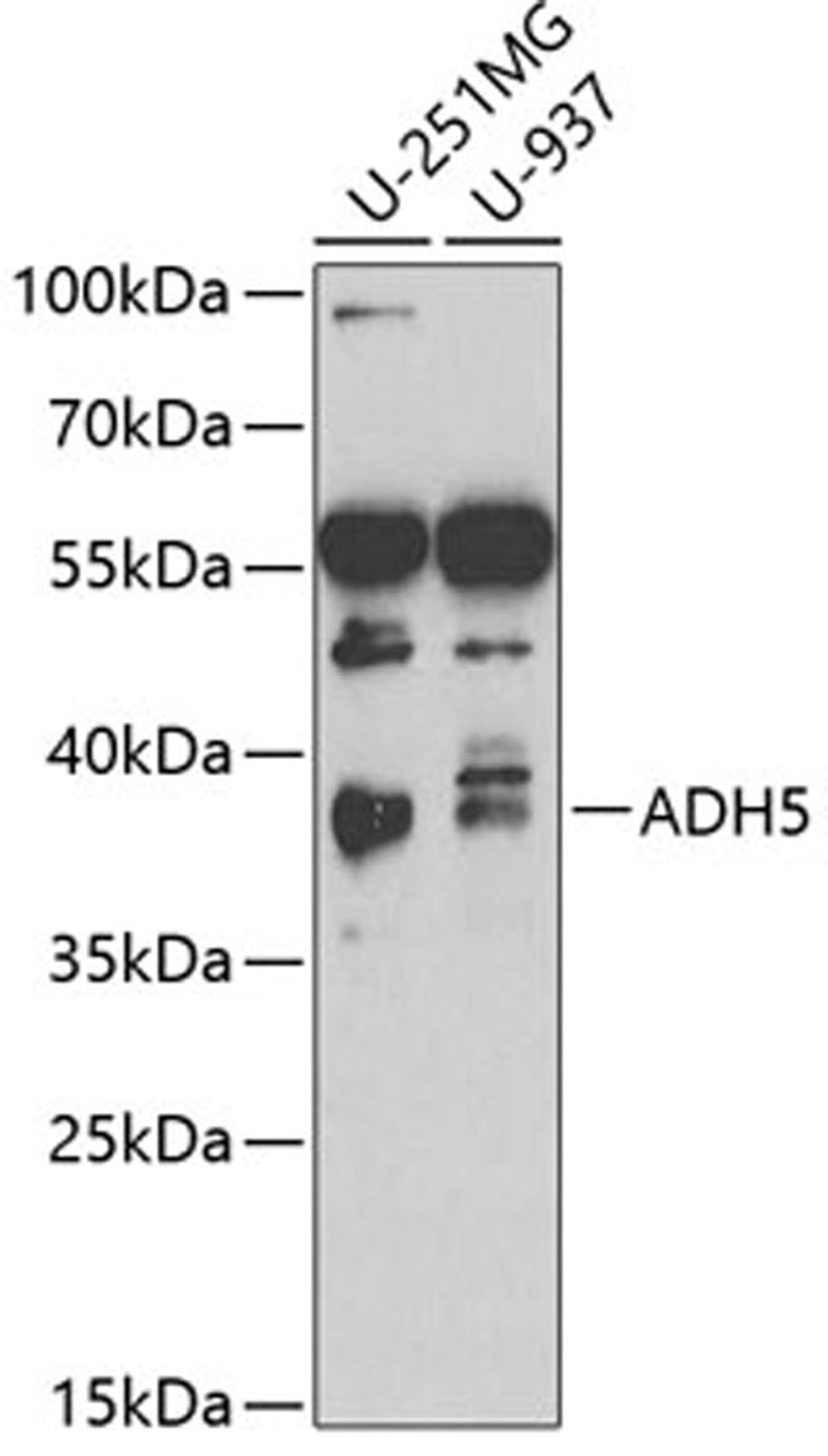 Western blot - ADH5 antibody (A2041)