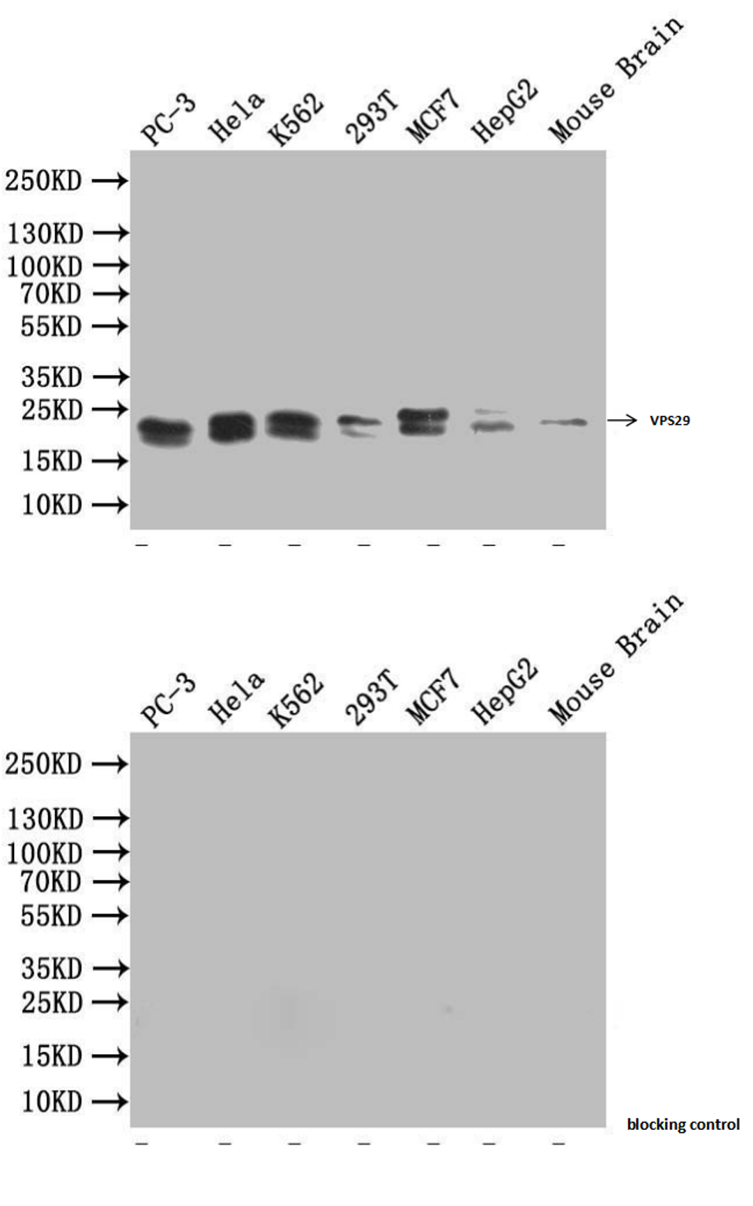 Western Blot. Positive WB detected in: PC3 whole cell lysate, Hela whole cell lysate, K562 whole cell lysate, THP-1 whole cell lysate, A431 whole cell lysate. All lanes: VPS29 antibody at 1:2000. Secondary. Goat polyclonal to rabbit IgG at 1/50000 dilution. Predicted band size: 21 KDa. Observed band size: 21 KDa. Exposure time：5min. 