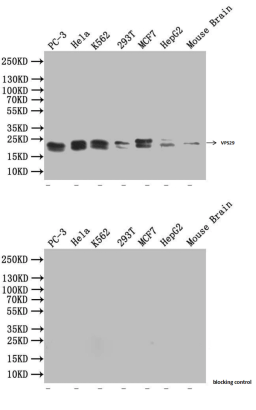 Western Blot. Positive WB detected in: PC3 whole cell lysate, Hela whole cell lysate, K562 whole cell lysate, THP-1 whole cell lysate, A431 whole cell lysate. All lanes: VPS29 antibody at 1:2000. Secondary. Goat polyclonal to rabbit IgG at 1/50000 dilution. Predicted band size: 21 KDa. Observed band size: 21 KDa. Exposure time：5min. 