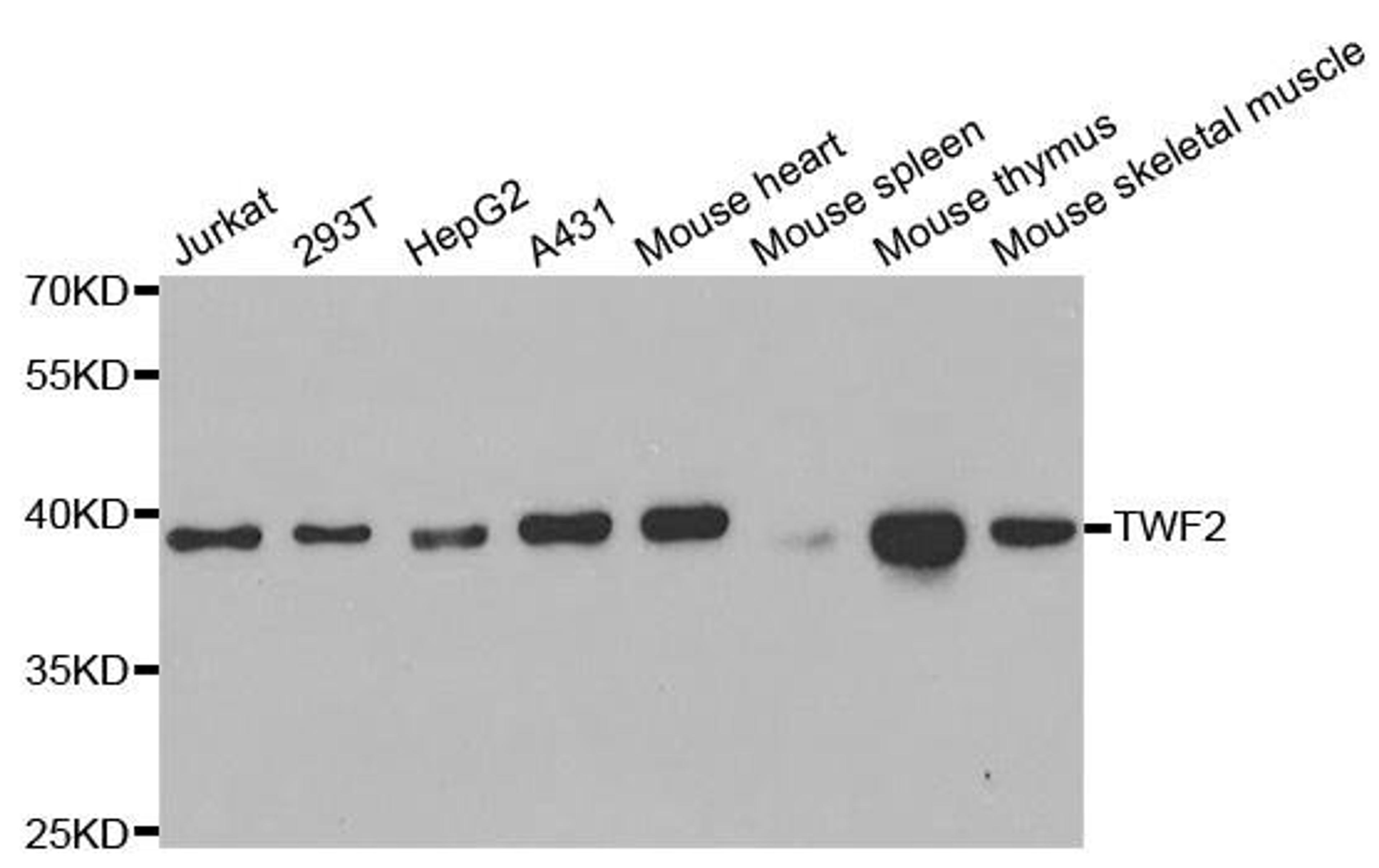 Western blot analysis of extracts of various cell lines using TWF2 antibody