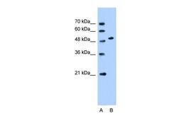 Antibody used in WB on Human HepG2 at 0.2-1 ug/ml.