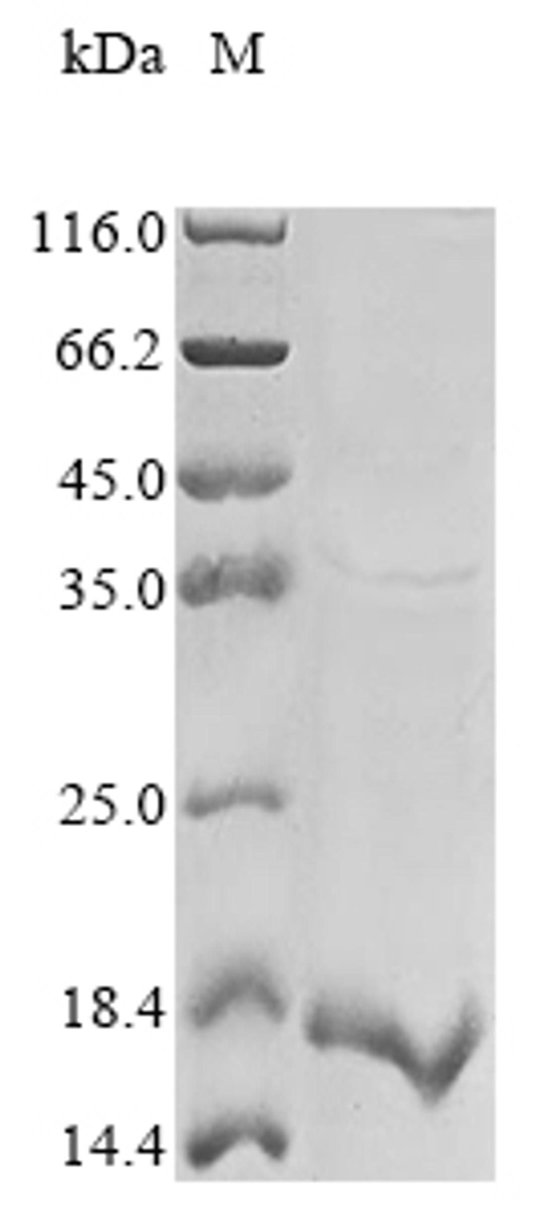 (Tris-Glycine gel) Discontinuous SDS-PAGE (reduced) with 5% enrichment gel and 15% separation gel.