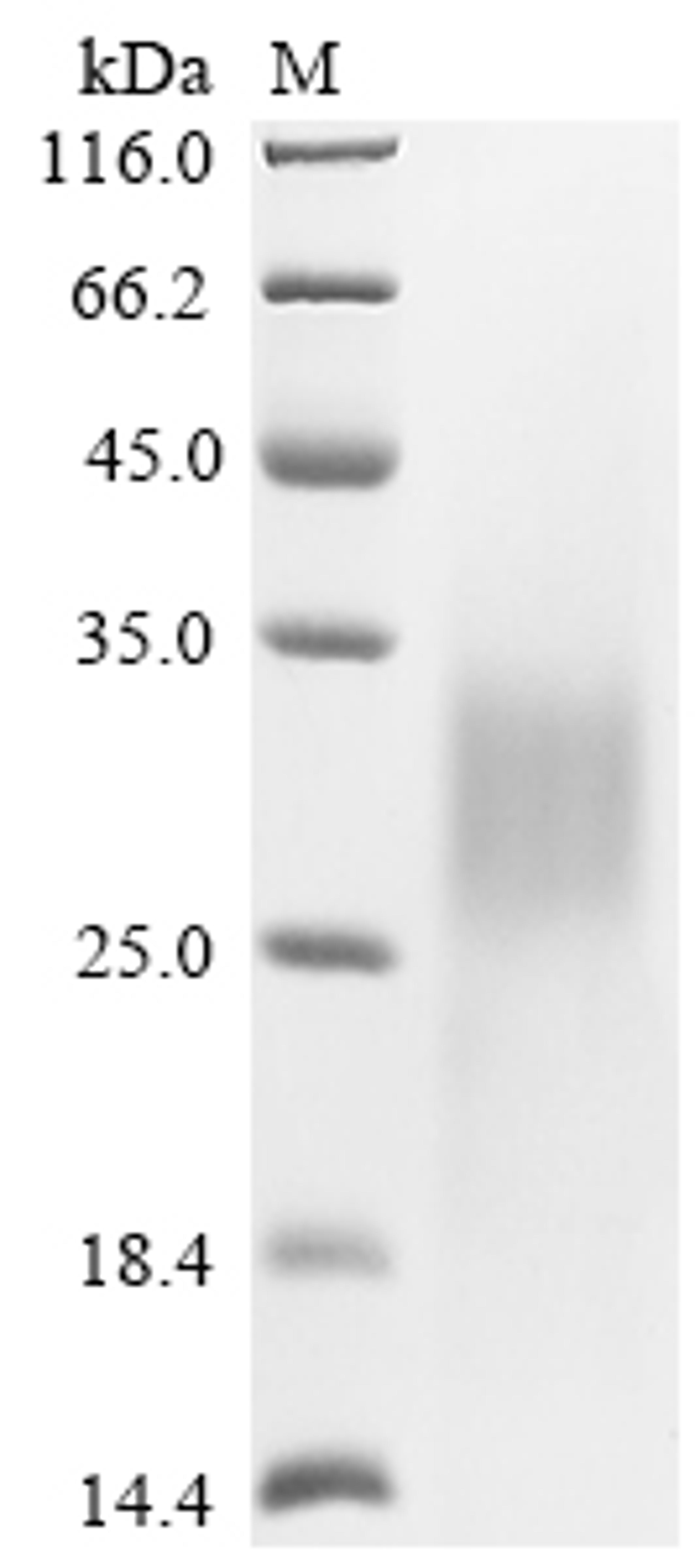 (Tris-Glycine gel) Discontinuous SDS-PAGE (reduced) with 5% enrichment gel and 15% separation gel.