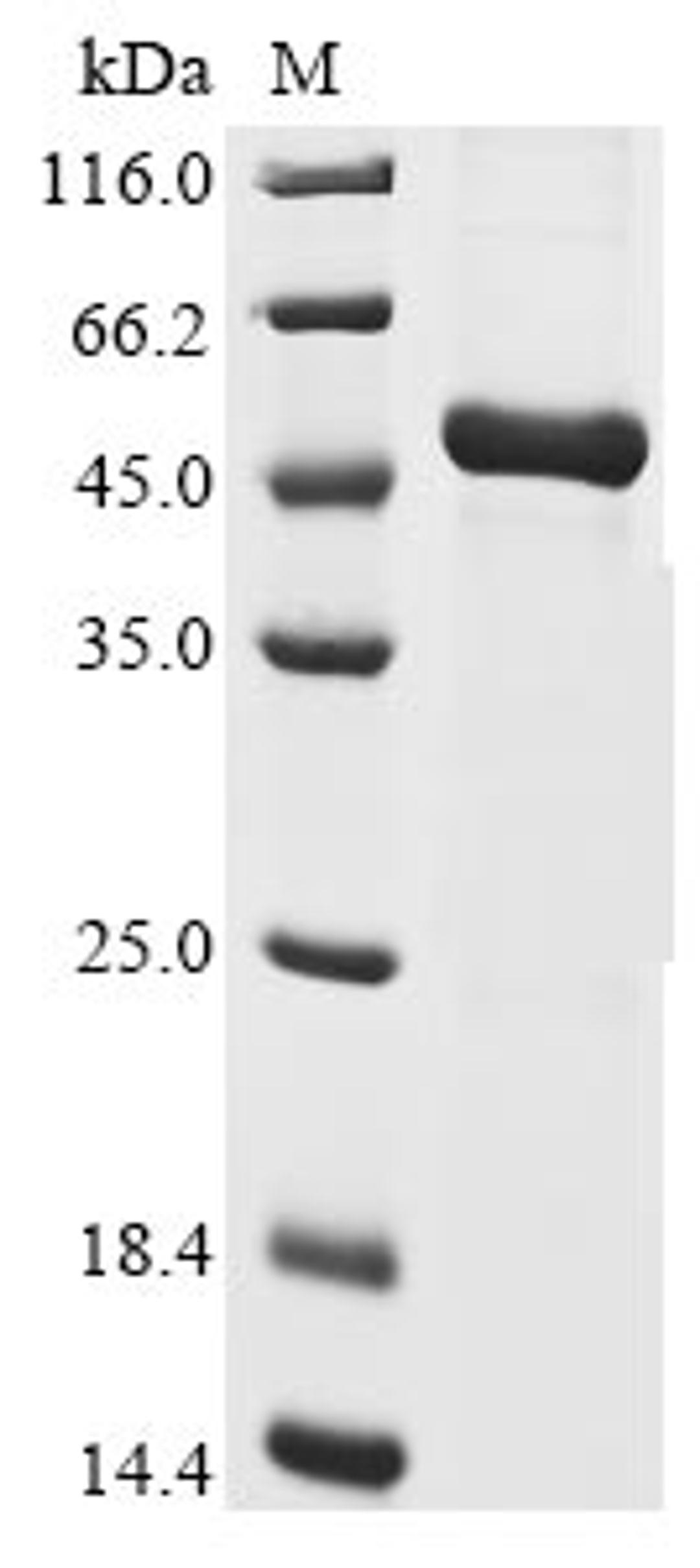 (Tris-Glycine gel) Discontinuous SDS-PAGE (reduced) with 5% enrichment gel and 15% separation gel.