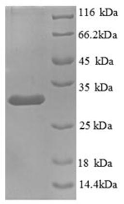 (Tris-Glycine gel) Discontinuous SDS-PAGE (reduced) with 5% enrichment gel and 15% separation gel.