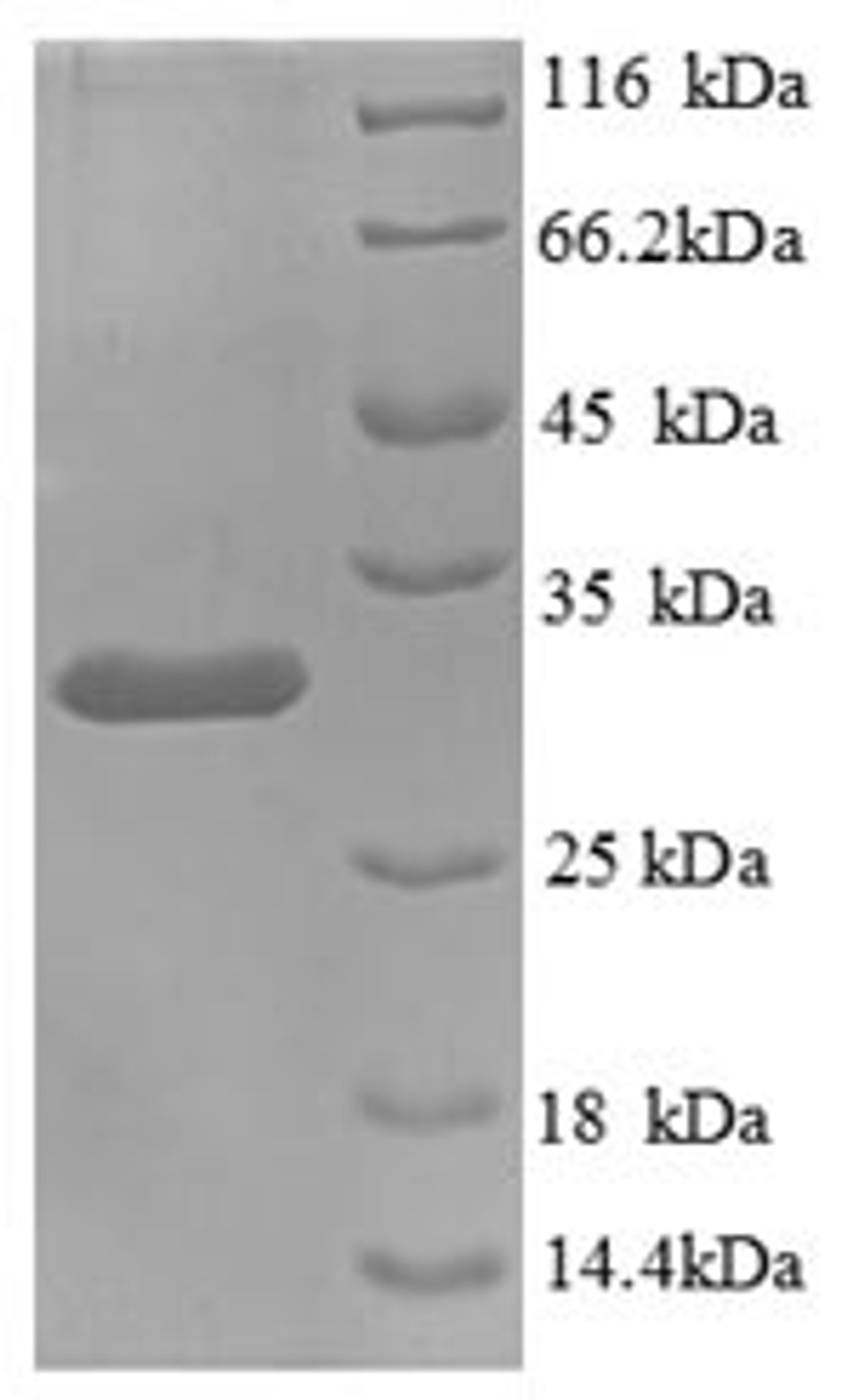 (Tris-Glycine gel) Discontinuous SDS-PAGE (reduced) with 5% enrichment gel and 15% separation gel.