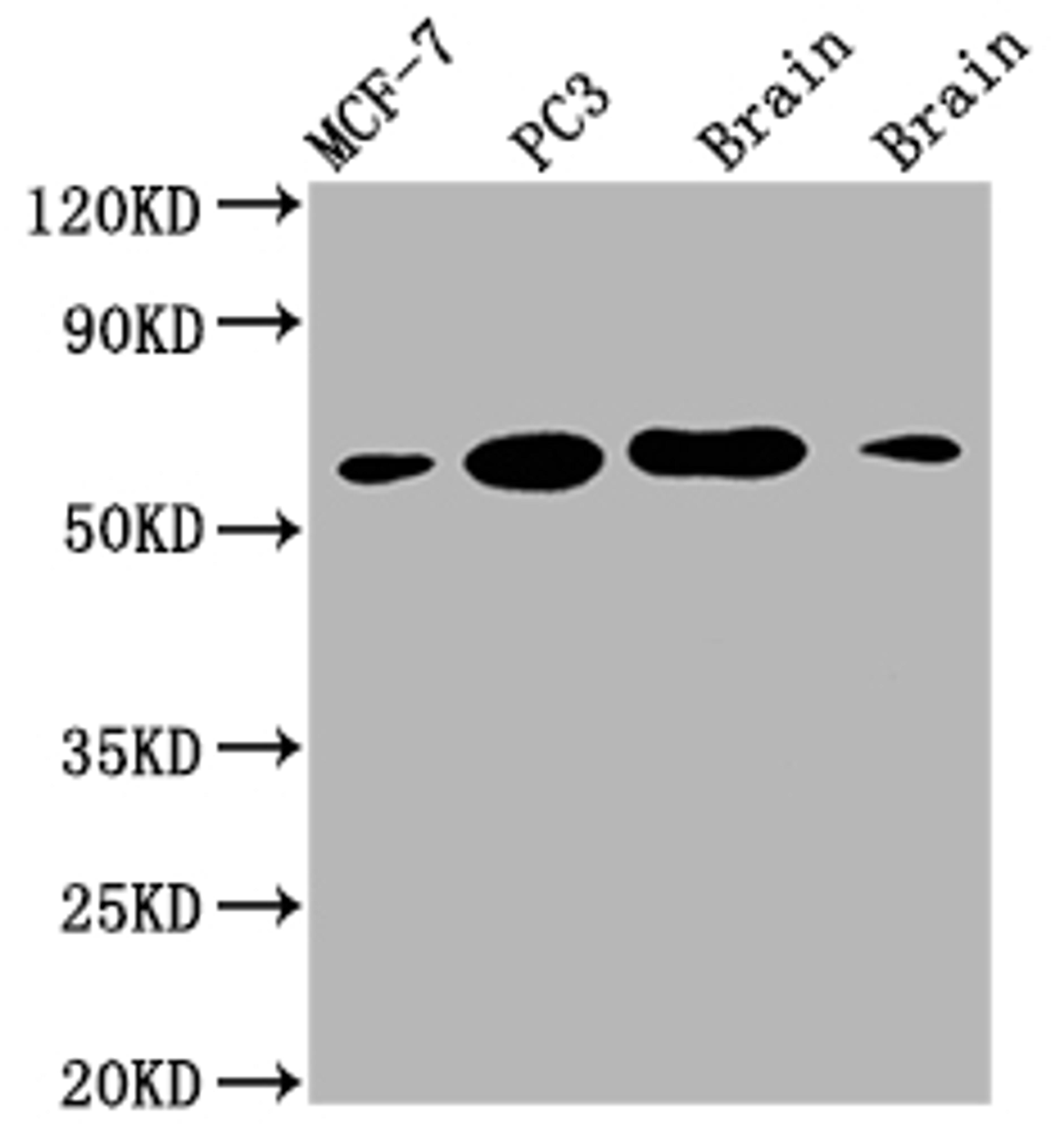 Western Blot. Positive WB detected in: MCF-7 whole cell lysate, PC3 whole cell lysate, Mouse brain tissue, Rat brain tissue. All lanes: LOXL2 antibody at 1:2000. Secondary. Goat polyclonal to rabbit IgG at 1/50000 dilution. Predicted band size: 87 kDa. Observed band size: 53 kDa. 