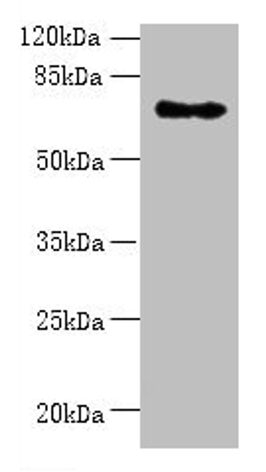 Western blot. All lanes: ZNF133 antibody at 5µg/ml + Hela whole cell lysate. Secondary. Goat polyclonal to rabbit IgG at 1/10000 dilution. Predicted band size: 74, 63, 67 kDa. Observed band size: 74 kDa