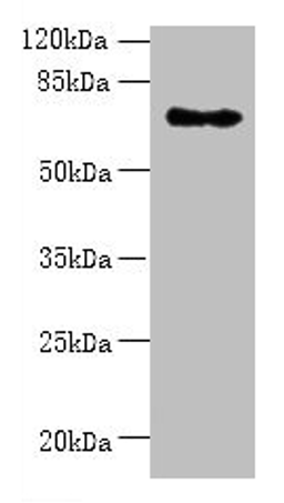 Western blot. All lanes: ZNF133 antibody at 5µg/ml + Hela whole cell lysate. Secondary. Goat polyclonal to rabbit IgG at 1/10000 dilution. Predicted band size: 74, 63, 67 kDa. Observed band size: 74 kDa