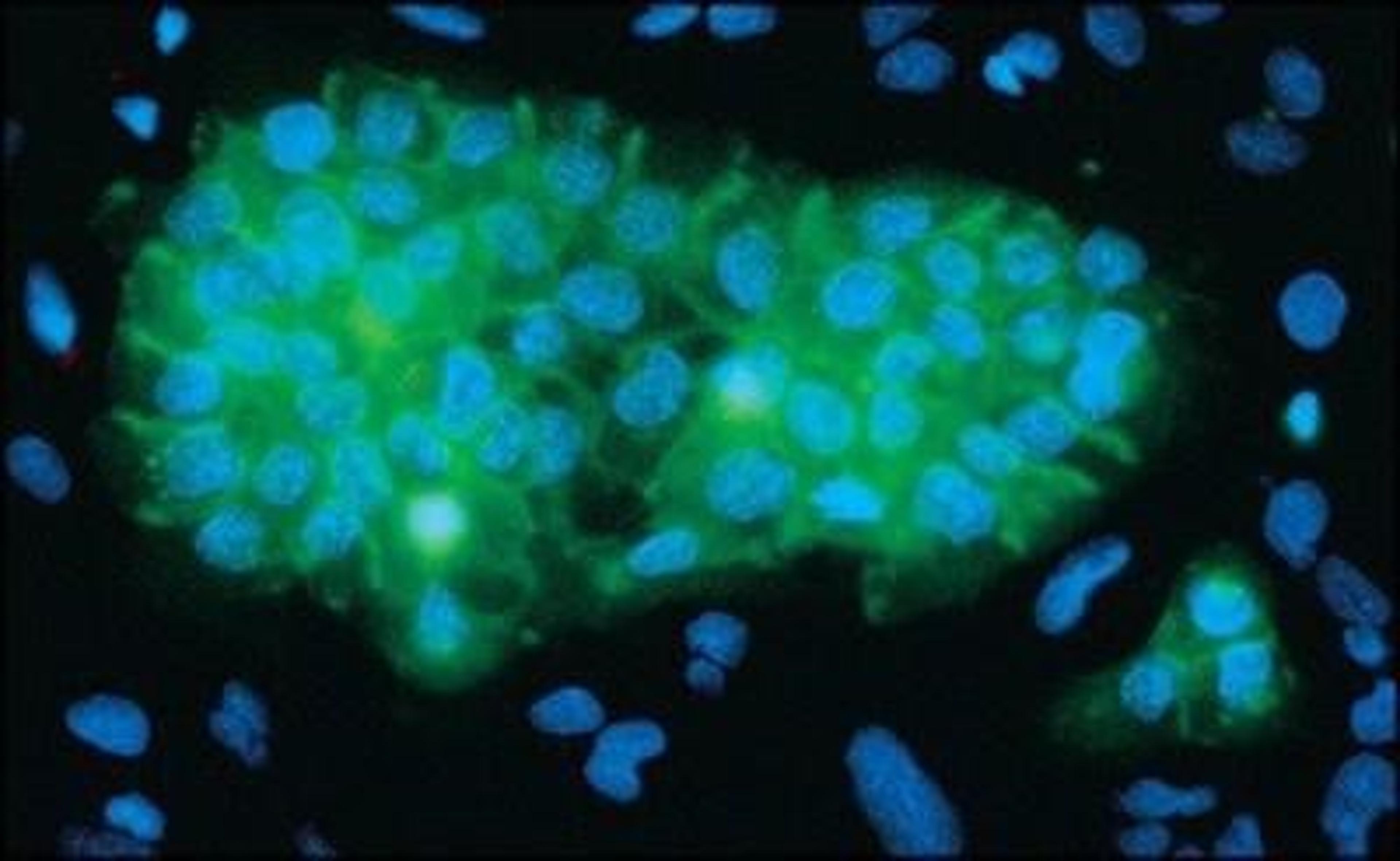 Immunocytochemistry/Immunofluorescence: EGFR Antibody (29.1) [NB120-10414] - Photomicrograph of a mixed cell culture of an amelanotic melanoma cell line (Hs695T) and an epidermoid carcinoma cell line (A431). Cells were grown on coverslips, fixed and stained with Monoclonal Anti-EGF Receptor (clone no. 29.1, NB120-10414). Green fluorescence; and Hoechst No. 33258 blue nuclear stain. Coverslips were photographed on a NIKON Microphot-FXA. From G. MacKenzie, Immunogen, Inc., Cambridge, MA.