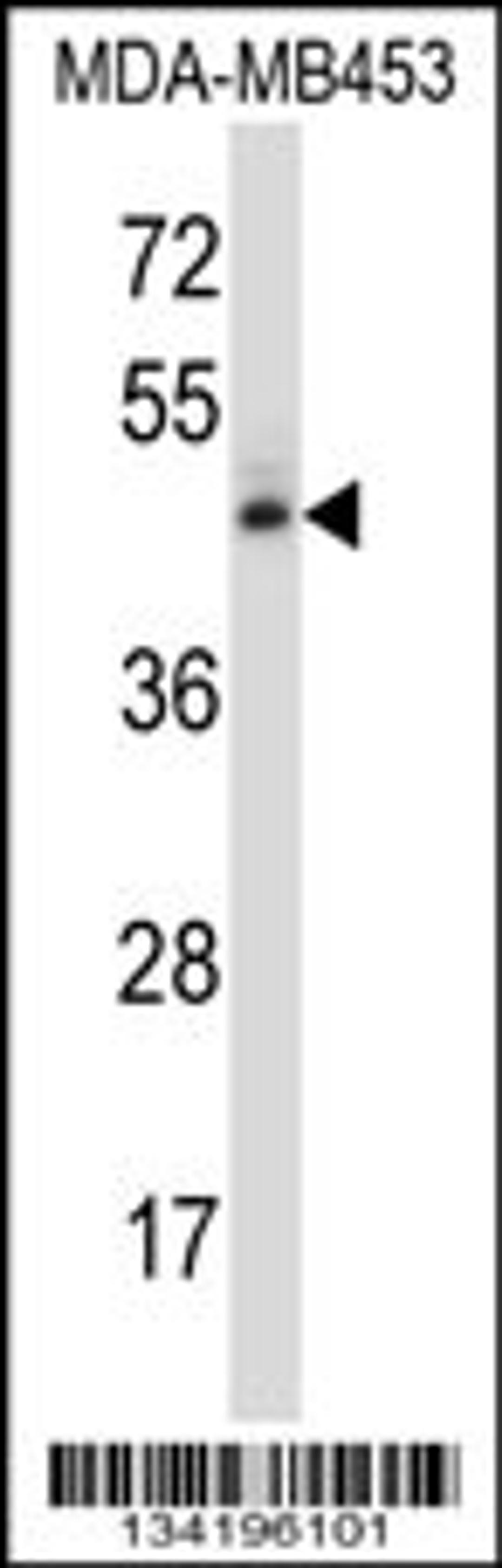 Western blot analysis in MDA-MB453 cell line lysates (35ug/lane).