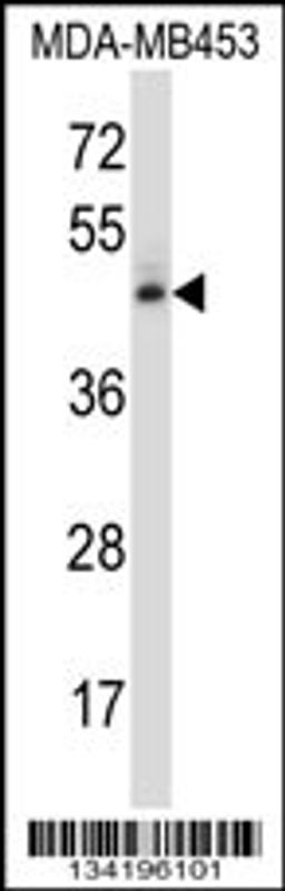 Western blot analysis in MDA-MB453 cell line lysates (35ug/lane).