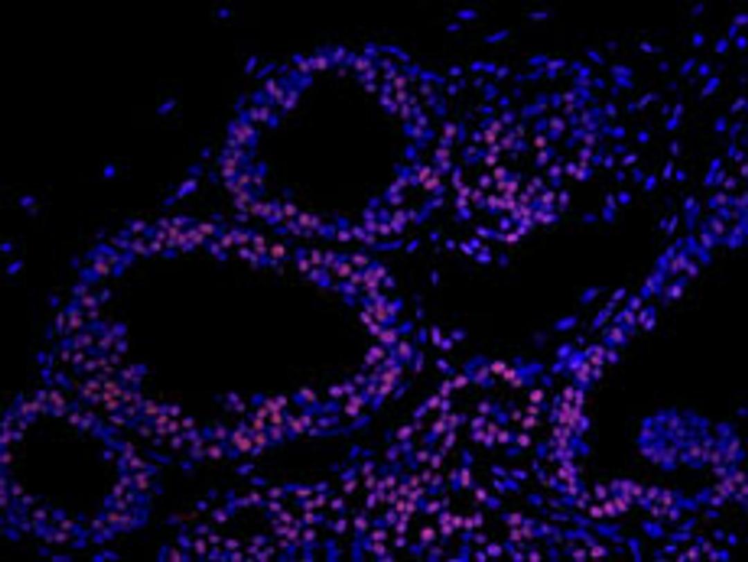 Detection of human Matrin 3 by immunohistochemistry.