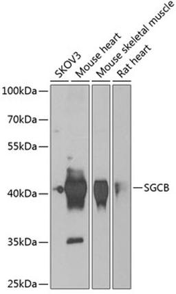 Western blot - SGCB antibody (A6979)