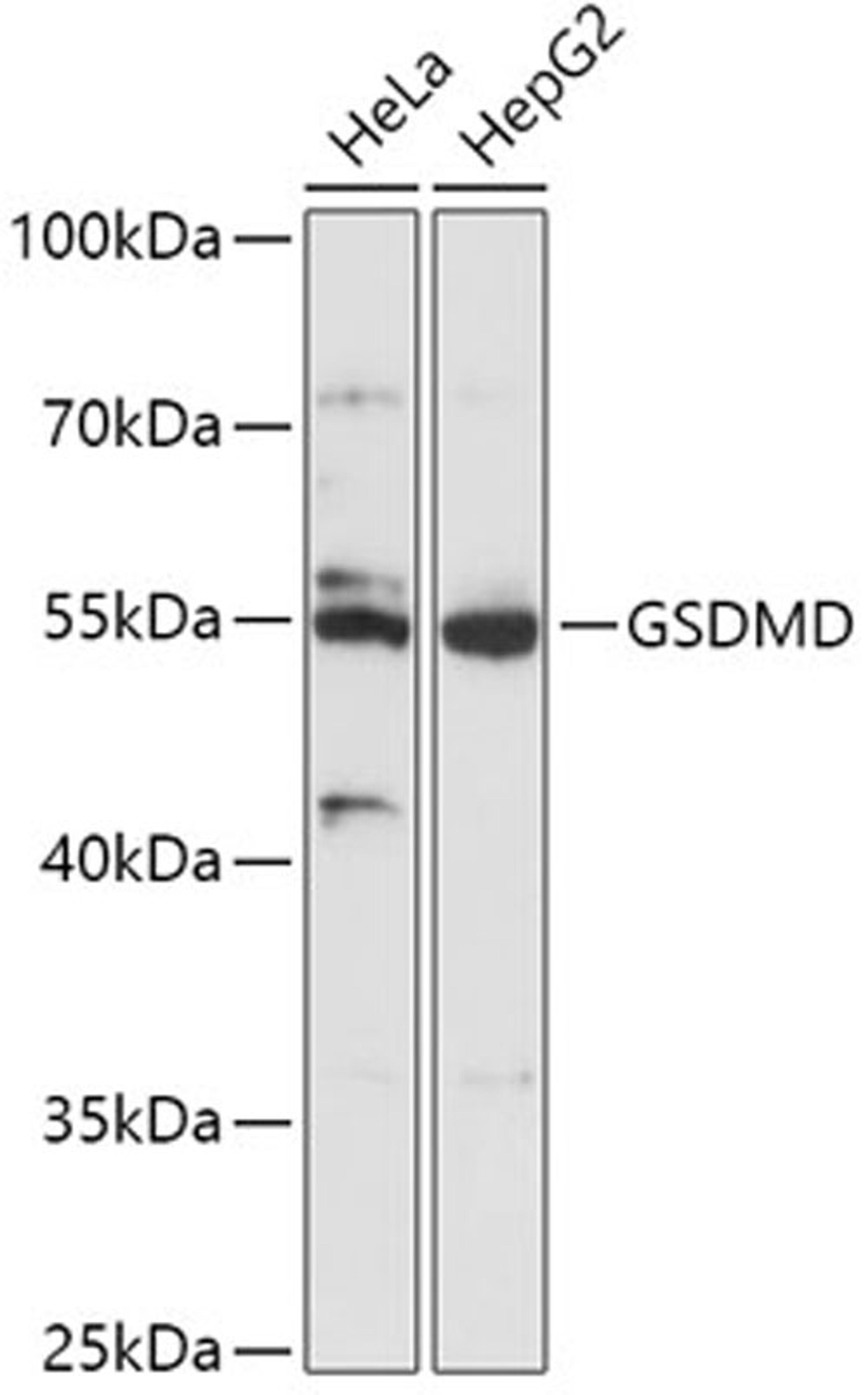 Western blot - GSDMD antibody (A17308)