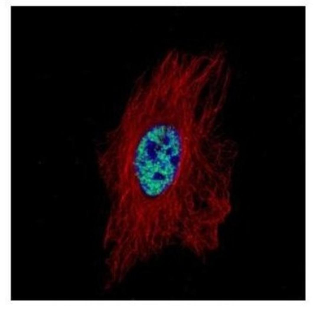 Immunocytochemistry/Immunofluorescence: TRIM47 Antibody [NBP2-20720] - Confocal immunofluorescence analysis of paraformaldehyde-fixed HeLa, using TRIM47 antibody (Green) at 1:500 dilution. Alpha-tubulin filaments are labeled with Alpha-tubulin antibody (Red) at 1:2000.