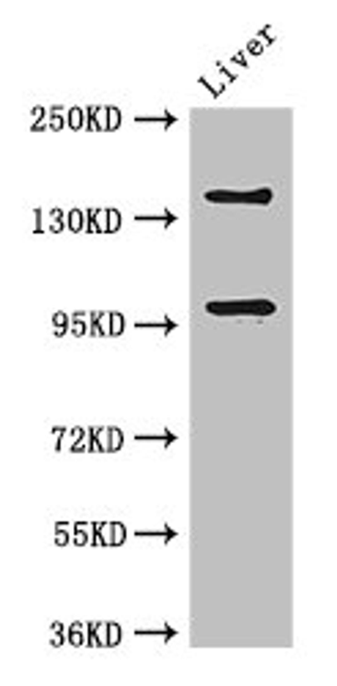 Western Blot. Positive WB detected in: Mouse liver tissue. All lanes: PHLDB2 antibody at 3ug/ml. Secondary. Goat polyclonal to rabbit IgG at 1/50000 dilution. Predicted band size: 143, 137, 140 kDa. Observed band size: 143, 96 kDa.
