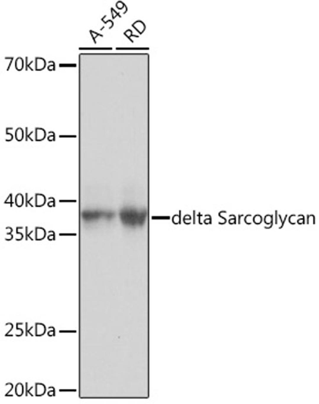 Western blot - delta Sarcoglycan Rabbit mAb (A9175)