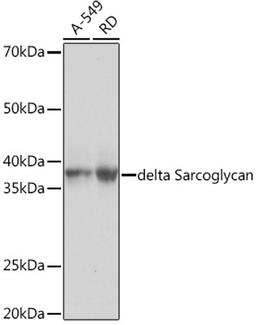 Western blot - delta Sarcoglycan Rabbit mAb (A9175)