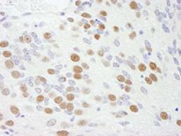 Detection of mouse RBM9 by immunohistochemistry.