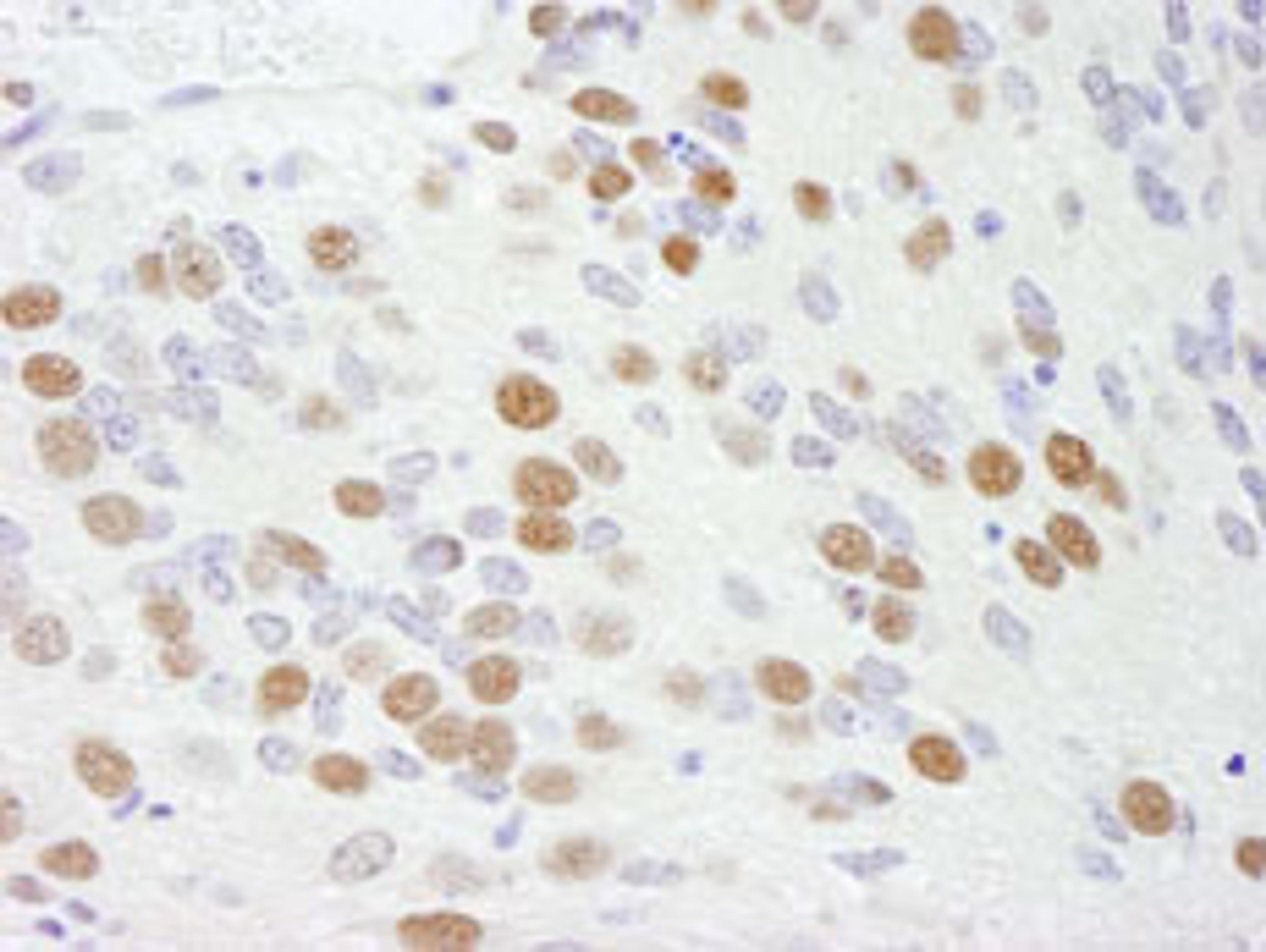 Detection of mouse RBM9 by immunohistochemistry.