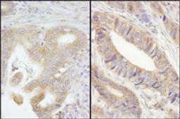 Detection of human PTPN12 by immunohistochemistry.