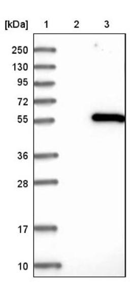 Western Blot: IHPK2 Antibody [NBP1-89635] - Lane 1: Marker [kDa] 250, 130, 95, 72, 55, 36, 28, 17, 10<br/>Lane 2: Negative control (vector only transfected HEK293T lysate)<br/>Lane 3: Over-expression lysate (Co-expressed with a C-terminal myc-DDK tag (~3.1 kDa) in mammalian HEK293T cells, LY414064)