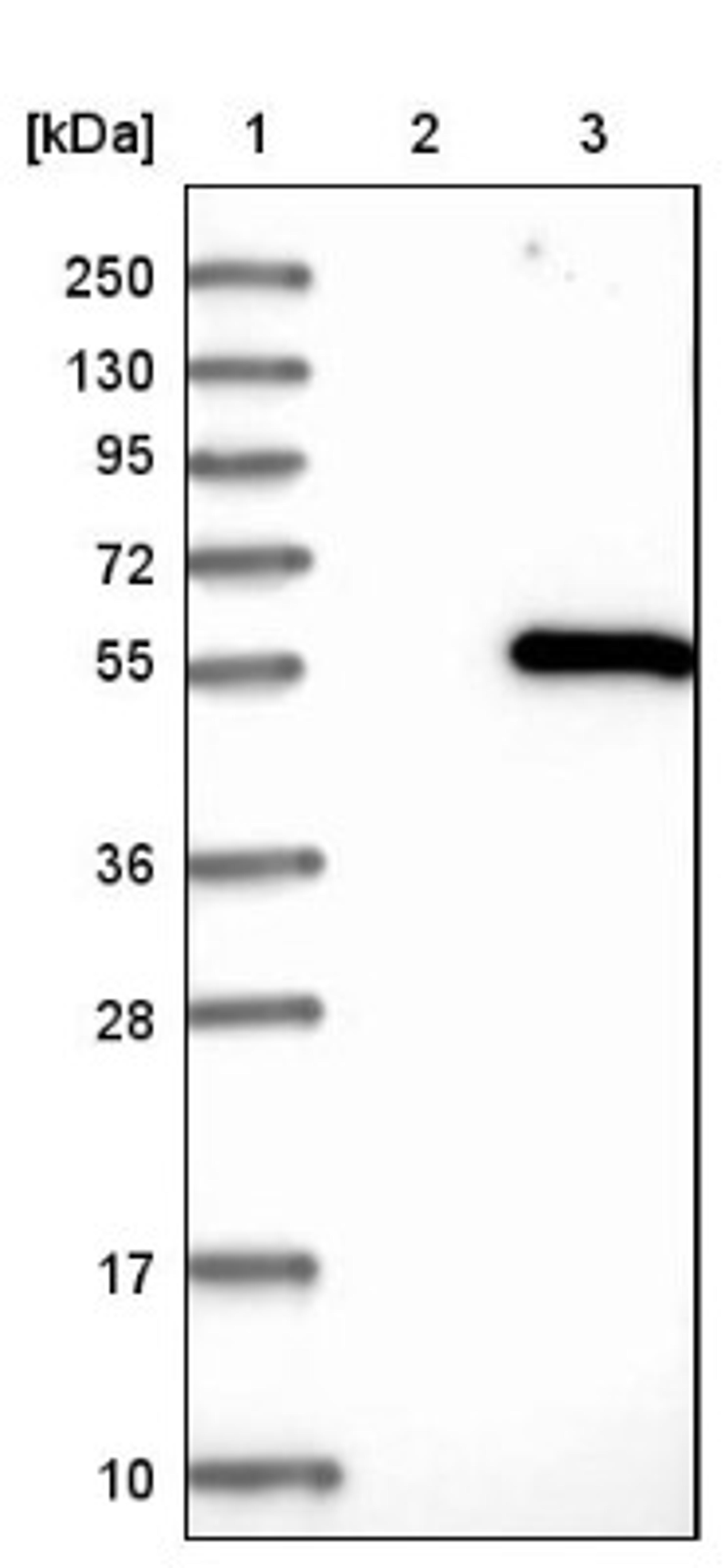 Western Blot: IHPK2 Antibody [NBP1-89635] - Lane 1: Marker [kDa] 250, 130, 95, 72, 55, 36, 28, 17, 10<br/>Lane 2: Negative control (vector only transfected HEK293T lysate)<br/>Lane 3: Over-expression lysate (Co-expressed with a C-terminal myc-DDK tag (~3.1 kDa) in mammalian HEK293T cells, LY414064)