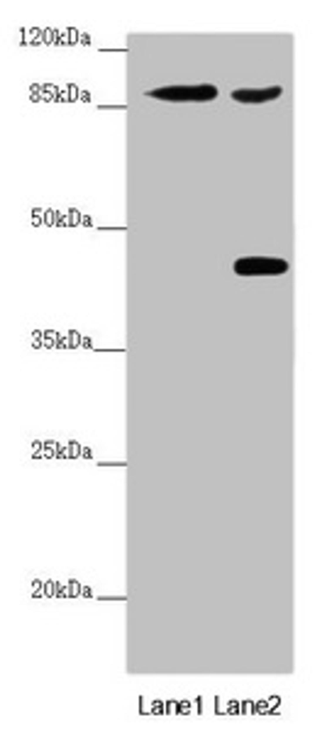 Western blot. All lanes: SPICE1 antibody at 5.43 ug/ml. Lane 1: Mouse gonadal tissue. Lane 2: 293T whole cell lysate. Secondary. Goat polyclonal to rabbit IgG at 1/10000 dilution. Predicted band size: 96 kDa. Observed band size: 96, 45 kDa.