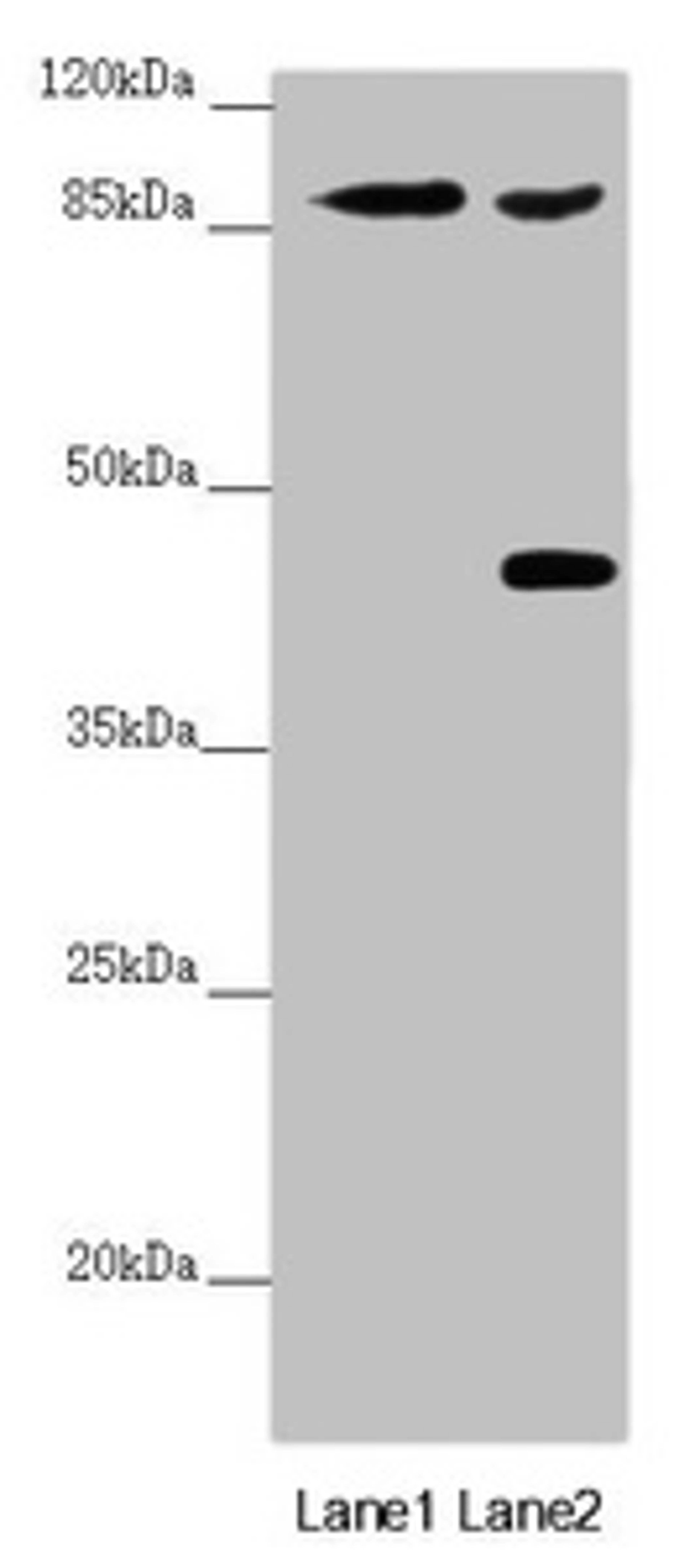 Western blot. All lanes: SPICE1 antibody at 5.43 ug/ml. Lane 1: Mouse gonadal tissue. Lane 2: 293T whole cell lysate. Secondary. Goat polyclonal to rabbit IgG at 1/10000 dilution. Predicted band size: 96 kDa. Observed band size: 96, 45 kDa.