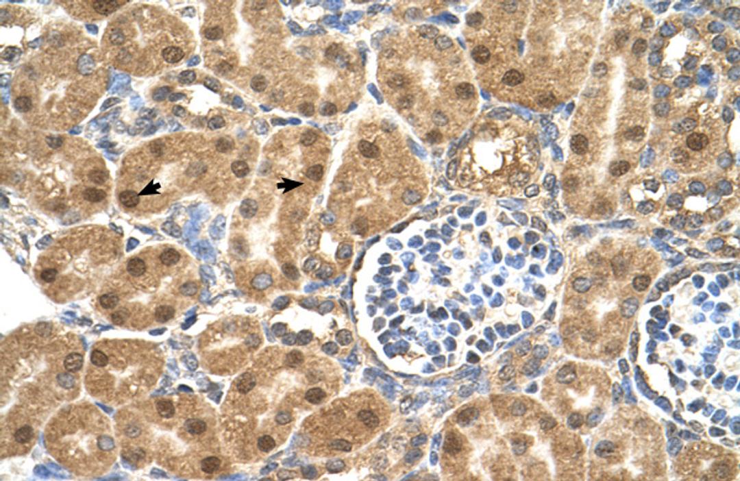 Antibody used in IHC on Human kidney.