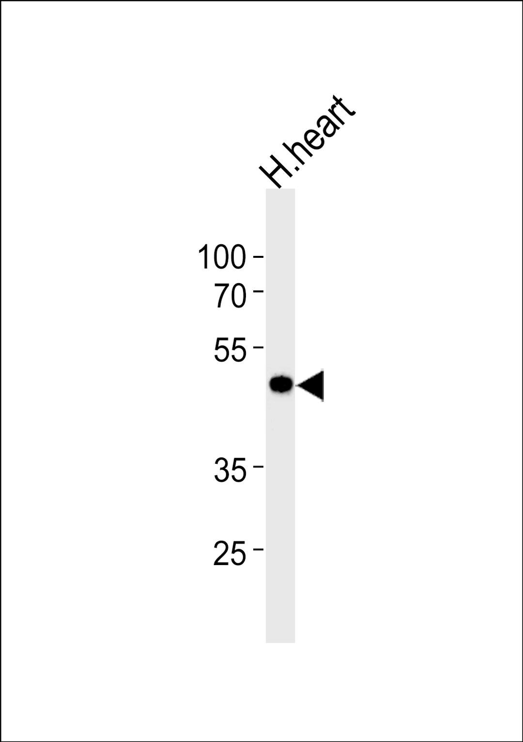 Western blot analysis of lysate from human heart tissue lysate, using KCNAB1 Antibody at 1:1000 at each lane.