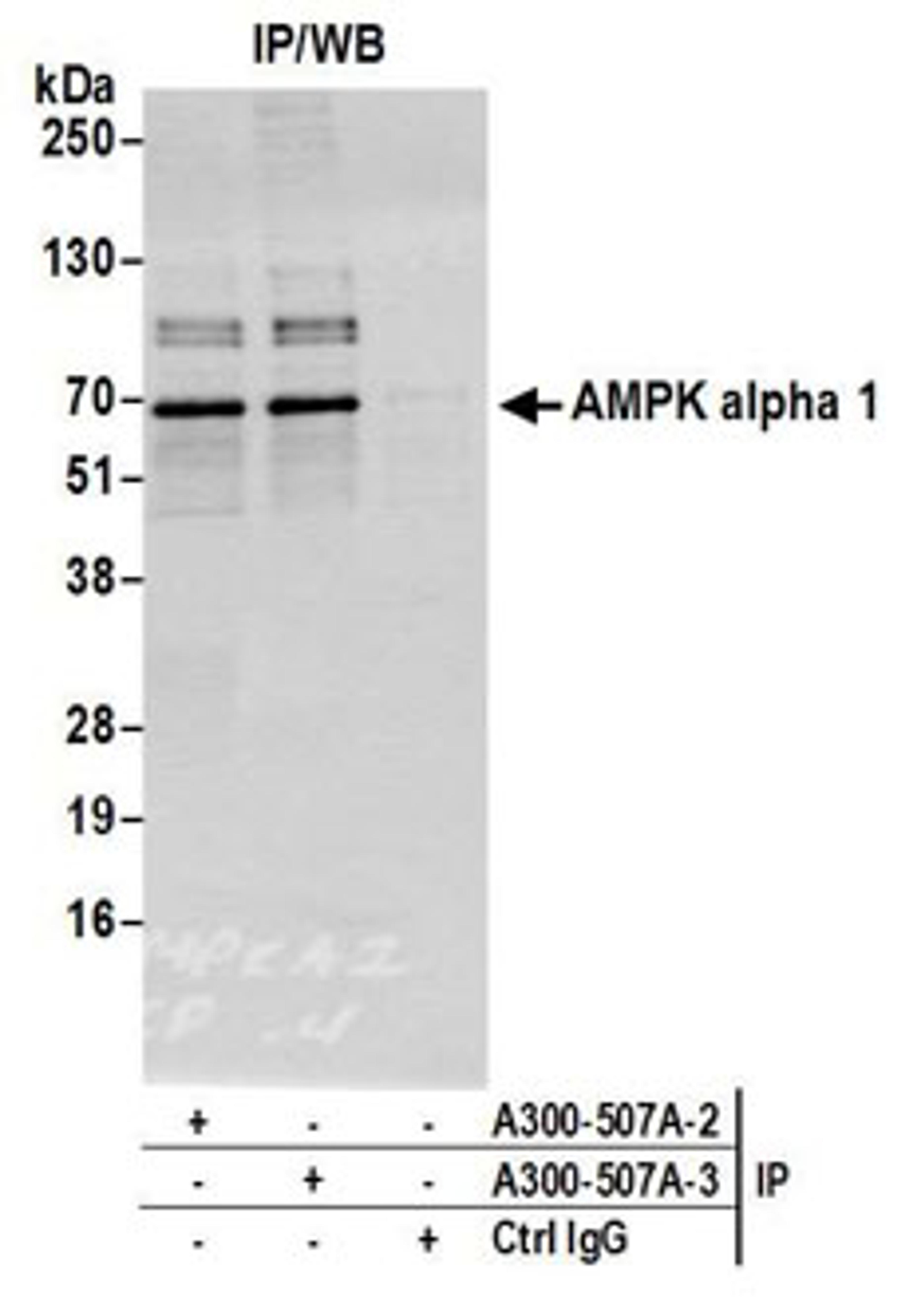 Detection of human AMPK alpha 1 by western blot of immunoprecipitates.