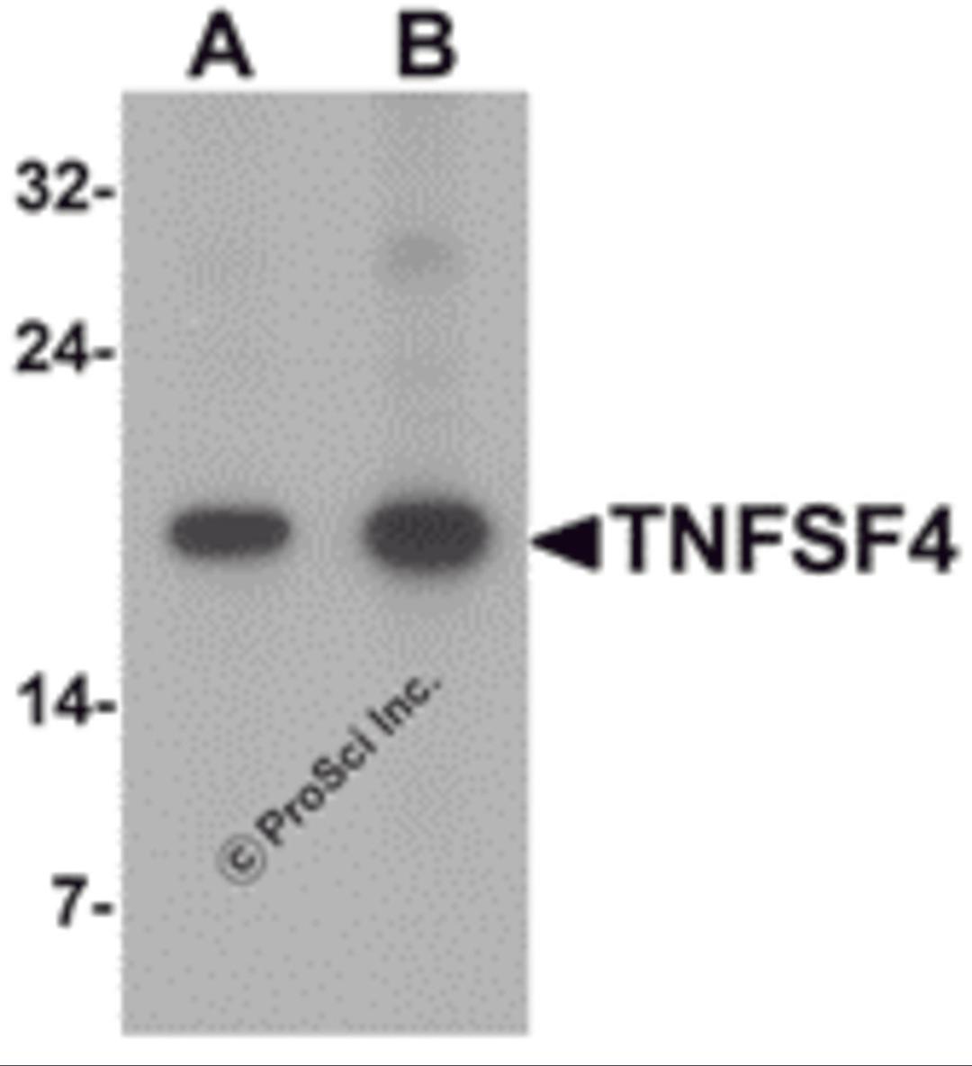 Western blot analysis of TNFSF4 in rat spleen tissue lysate with TNFSF4 antibody at (A) 0.5 and (B) 1 μg/mL