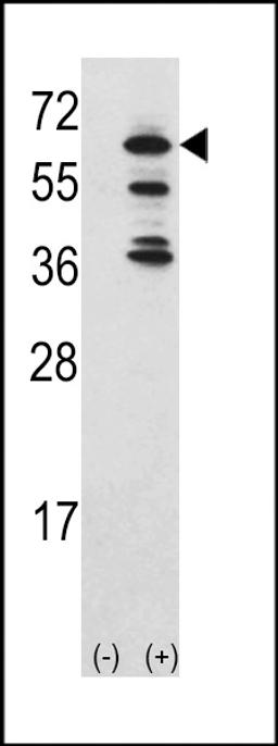 Western blot analysis of ACK1 using rabbit polyclonal ACK1 Antibody using 293 cell lysates (2 ug/lane) either nontransfected (Lane 1) or transiently transfected with the ACK1 gene (Lane 2) (60 KD recombinant protein).