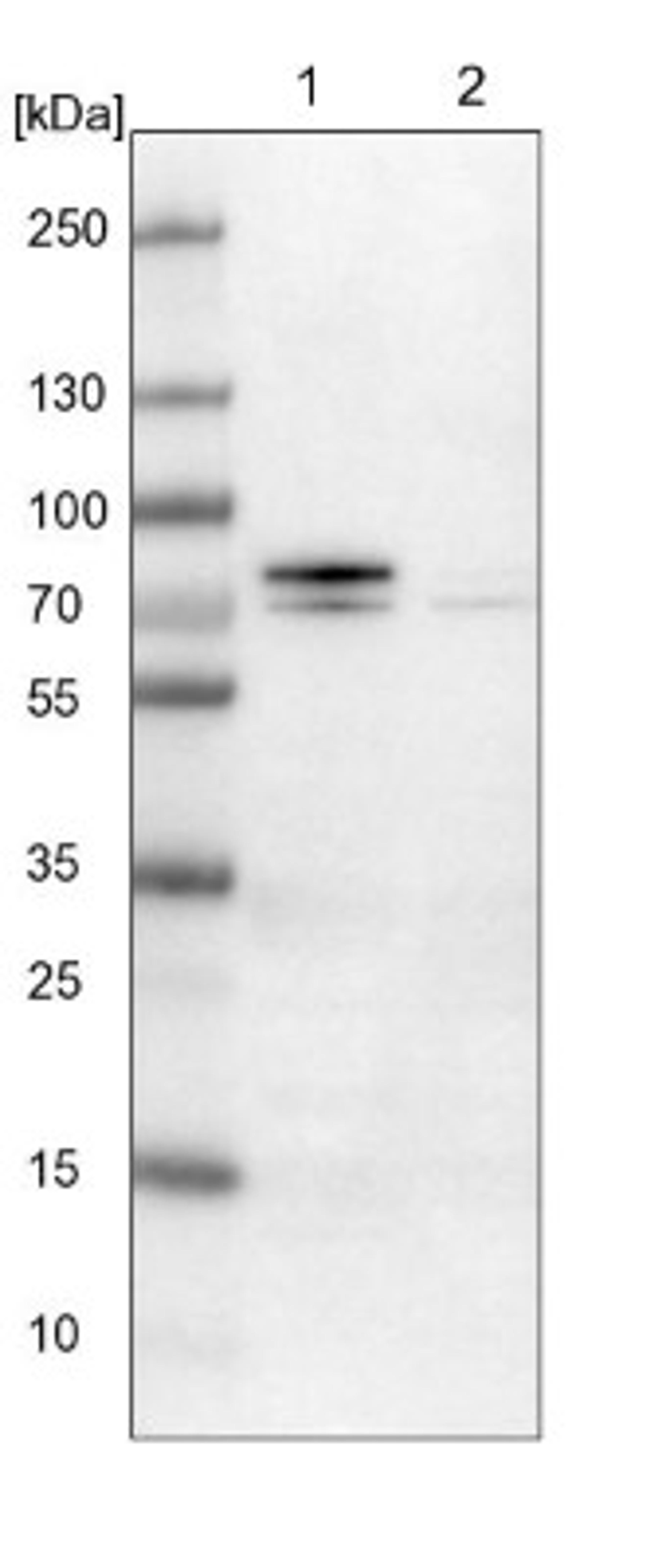 Western Blot: Gamma-Glutamyltransferase 7 Antibody [NBP1-84319] - Lane 1: NIH-3T3 cell lysate (Mouse embryonic fibroblast cells)<br/>Lane 2: NBT-II cell lysate (Rat Wistar bladder tumour cells)