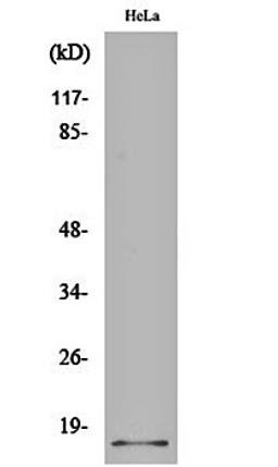 Western blot analysis of Hela cell lysates using p14 antibody