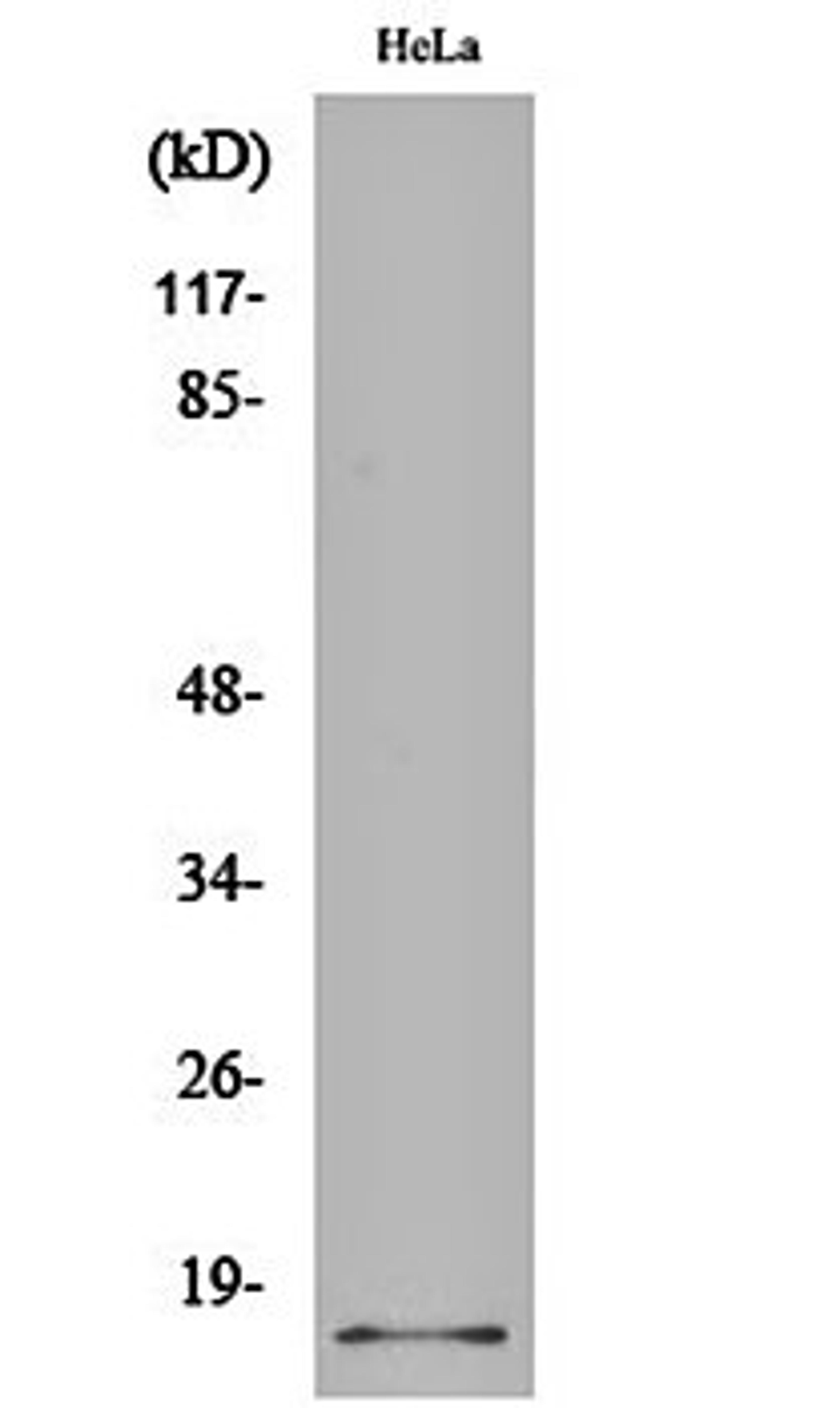 Western blot analysis of Hela cell lysates using p14 antibody