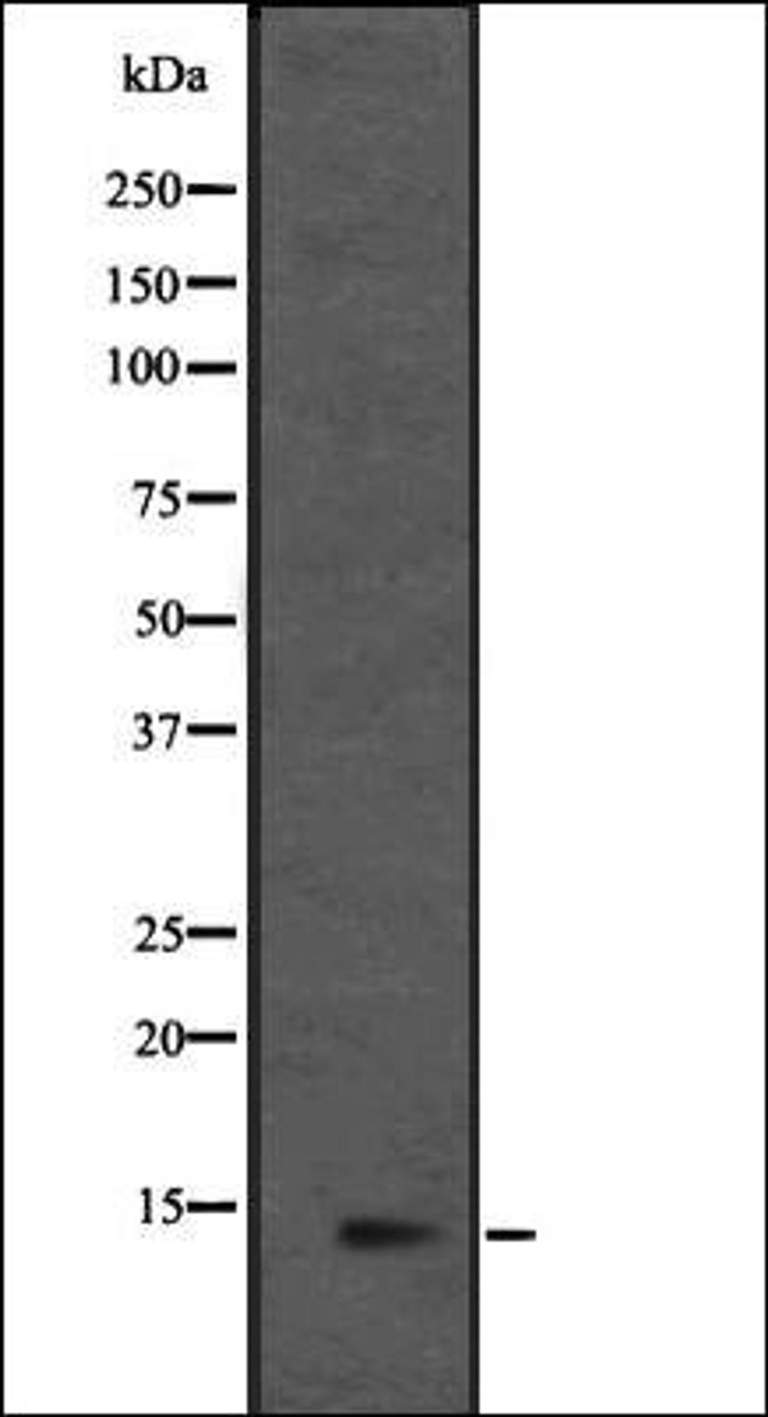 Western blot analysis of HEK293 cells using L36mt antibody