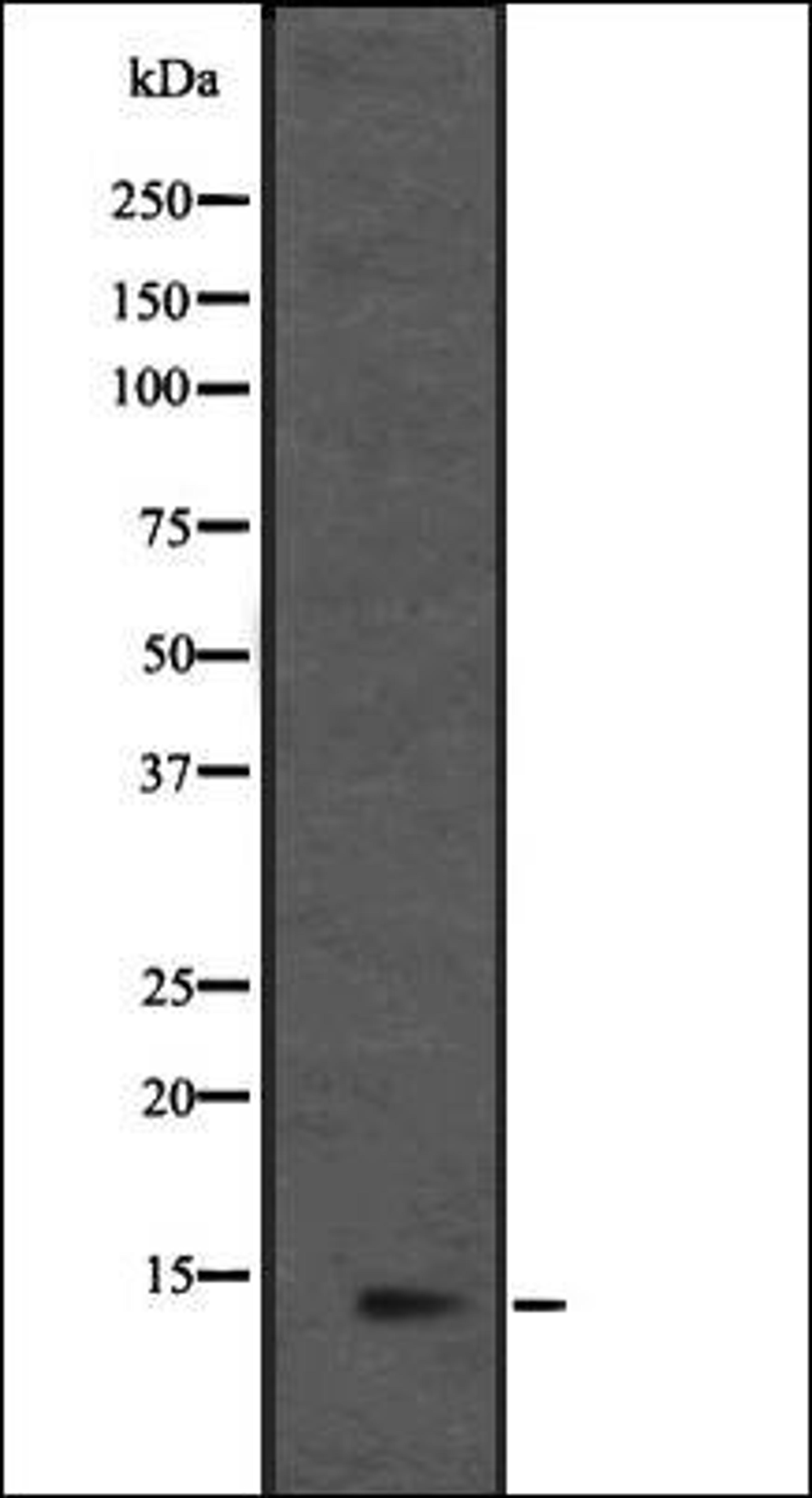 Western blot analysis of HEK293 cells using L36mt antibody