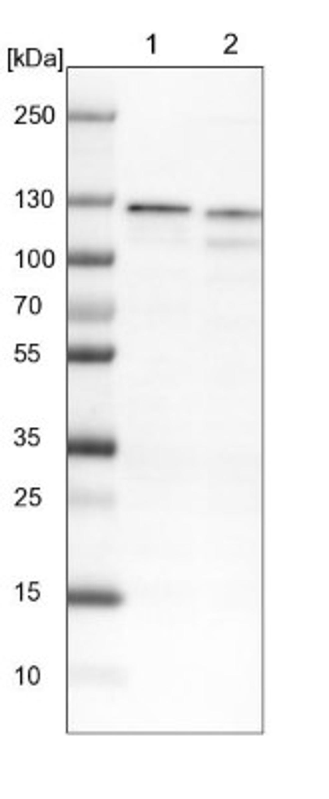 Western Blot: DDX42 Antibody [NBP1-87134] - Lane 1: NIH-3T3 cell lysate (Mouse embryonic fibroblast cells)<br/>Lane 2: NBT-II cell lysate (Rat Wistar bladder tumour cells)